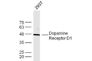 Dopamine Receptor d1 antibody  (AA 101-200)
