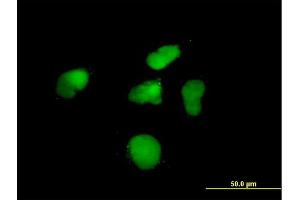 anti-Zinc Finger Protein 79 (ZNF79) (AA 1-498) antibody