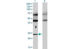 Image no. 3 for anti-Transcription Factor EC (TFEC) (AA 1-89) antibody (ABIN524764)