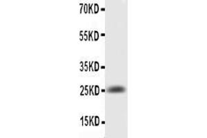 Image no. 2 for anti-Interleukin 6 (IL6) (AA 25-211) antibody (ABIN3042526)