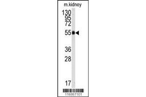 Image no. 1 for anti-Aldehyde Dehydrogenase 9 Family, Member A1 (ALDH9A1) (AA 445-477), (C-Term) antibody (ABIN392321)