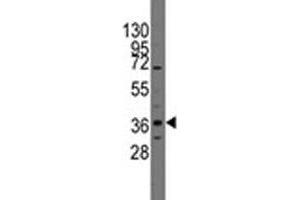 Image no. 2 for anti-Paired-Like Homeodomain 2 (PITX2) (AA 122-151) antibody (ABIN3032141)