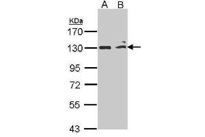 Image no. 1 for anti-Mitogen-Activated Protein Kinase Kinase Kinase 14 (MAP3K14) (N-Term) antibody (ABIN2855401)
