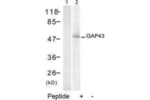 Image no. 2 for anti-Growth Associated Protein 43 (GAP43) (Ser41) antibody (ABIN197546)