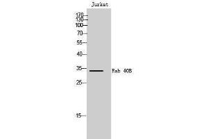 Image no. 1 for anti-RAB40B, Member RAS Oncogene Family (RAB40B) (C-Term) antibody (ABIN3186627)