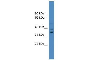Image no. 1 for anti-Ubiquitin Fusion Degradation Protein 1 Homolog (UFD1L) (Middle Region) antibody (ABIN929227)