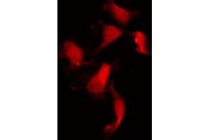 Image no. 2 for anti-Neurofibromin 2 (NF2) (pSer518) antibody (ABIN6256364)