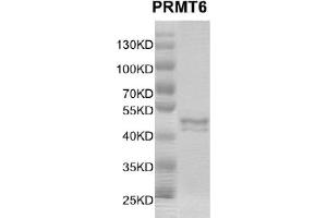 Image no. 2 for Protein Arginine Methyltransferase 6 (PRMT6) protein (DYKDDDDK Tag) (ABIN2669659)