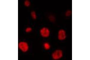 Image no. 1 for anti-ELAV (Embryonic Lethal, Abnormal Vision, Drosophila)-Like 2 (Hu Antigen B) (ELAVL2) (N-Term) antibody (ABIN6258767)
