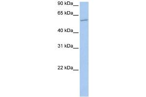 Image no. 1 for anti-Membrane Bound O-Acyltransferase Domain Containing 1 (MBOAT1) antibody (ABIN2459208)