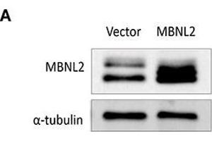 Image no. 5 for anti-alpha Tubulin (TUBA1) (Center) antibody (ABIN2855283)