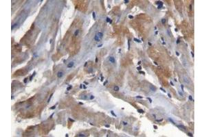 Image no. 3 for anti-Secreted Frizzled-Related Protein 1 (SFRP1) (AA 32-314) antibody (ABIN1078520)
