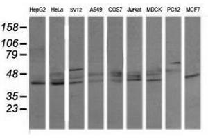 Image no. 3 for anti-Mitogen-Activated Protein Kinase 13 (MAPK13) antibody (ABIN1499952)