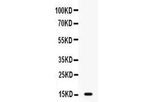 Image no. 1 for anti-Gastric Inhibitory Polypeptide (GIP) (AA 52-93) antibody (ABIN4886602)