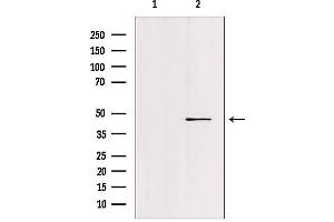 Image no. 1 for anti-Forkhead Box N2 (FOXN2) (C-Term) antibody (ABIN6258924)