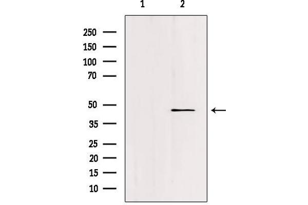 FOXN2 antibody  (C-Term)