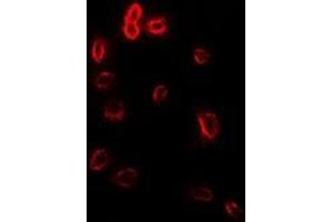 Image no. 1 for anti-Stomatin (STOM) (full length) antibody (ABIN6005338)
