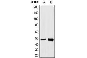 Image no. 2 for anti-Heterogeneous Nuclear Ribonucleoprotein H1 (H) (HNRNPH1) (Center) antibody (ABIN2706321)