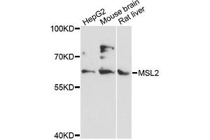 Image no. 1 for anti-Male-Specific Lethal 2 Homolog (MSL2) antibody (ABIN6293950)