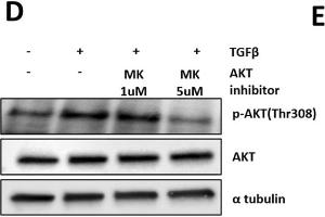 Image no. 12 for anti-alpha Tubulin (TUBA1) (C-Term) antibody (ABIN964563)