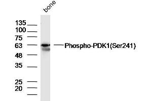 Image no. 6 for anti-3-phosphoinositide Dependent Protein Kinase-1 (PDPK1) (pSer241) antibody (ABIN744668)