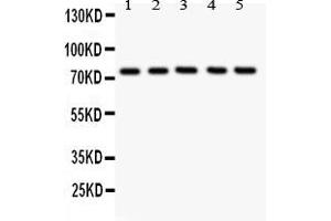 Image no. 1 for anti-Arachidonate 12-Lipoxygenase (ALOX12) (AA 609-628), (C-Term) antibody (ABIN5518671)