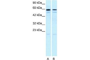 Image no. 2 for anti-5-Hydroxytryptamine (serotonin) Receptor 2C (HTR2C) (N-Term) antibody (ABIN2792274)
