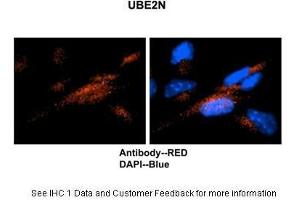 Image no. 5 for anti-Ubiquitin-Conjugating Enzyme E2N (UBE2N) (Middle Region) antibody (ABIN2777765)