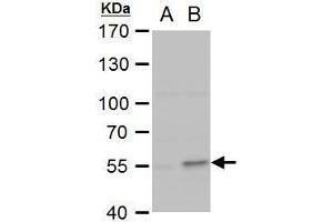 Image no. 2 for anti-Collagen, Type I, alpha 2 (COL1A2) (C-Term) antibody (ABIN2855530)