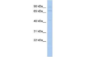 Image no. 2 for anti-Kelch-Like 3 (KLHL3) (N-Term) antibody (ABIN2775874)