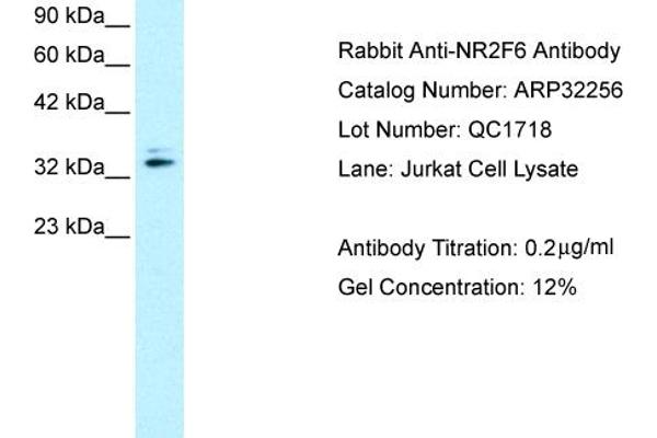 NR2F6 antibody  (N-Term)