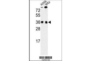 Image no. 1 for anti-serine/arginine-Rich Splicing Factor 1 (SRSF1) (AA 11-38), (N-Term) antibody (ABIN652256)