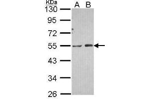 Image no. 2 for anti-Phosphatidylinositol-5-Phosphate 4-Kinase, Type II, alpha (PIP4K2A) (N-Term) antibody (ABIN2856349)
