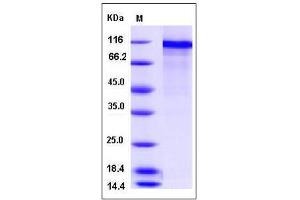 Image no. 1 for NEL-Like 2 (Chicken) (NELL2) (AA 1-816) protein (His tag) (ABIN2005474)