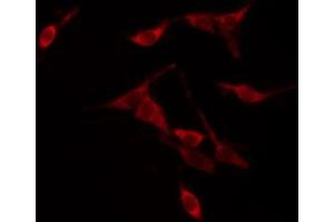 Image no. 3 for anti-14-3-3 zeta (YWHAZ) (pThr232) antibody (ABIN6256515)