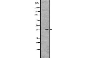 Image no. 1 for anti-Orthodenticle Homeobox 1 (OTX1) (Internal Region) antibody (ABIN6263919)