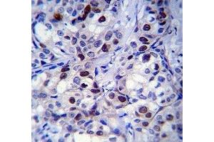 Image no. 3 for anti-Retinoblastoma Protein (Rb Protein) (AA 586-615) antibody (ABIN3032465)