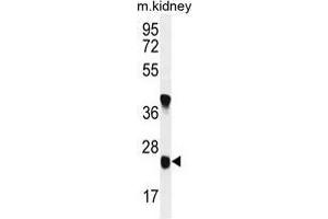 Image no. 1 for anti-Unc-119 Homolog B (UNC119B) (AA 207-236), (C-Term) antibody (ABIN955414)