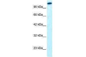 Image no. 2 for anti-GLI Family Zinc Finger 2 (GLI2) (Middle Region) antibody (ABIN2777474)