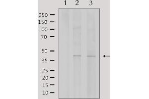 Image no. 2 for anti-Wilms Tumor 1 Associated Protein (WTAP) (C-Term) antibody (ABIN6257553)