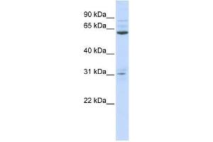 anti-Intestine-Specific Homeobox (ISX) (N-Term) antibody