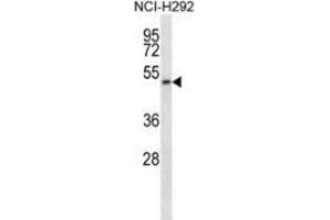 Image no. 1 for anti-Phosphatidylinositol Glycan T (PIGT) (AA 391-421), (C-Term) antibody (ABIN954139)