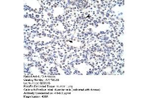 Image no. 3 for anti-Interleukin enhancer-binding factor 3 (ILF3) (N-Term) antibody (ABIN2780867)