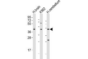 Image no. 3 for anti-Dopamine Receptor D2 (DRD2) (AA 307-336), (C-Term) antibody (ABIN5533174)