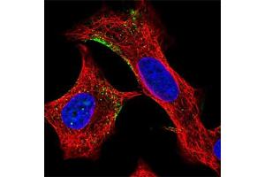 Image no. 3 for anti-Engulfment and Cell Motility 2 (ELMO2) antibody (ABIN5577234)
