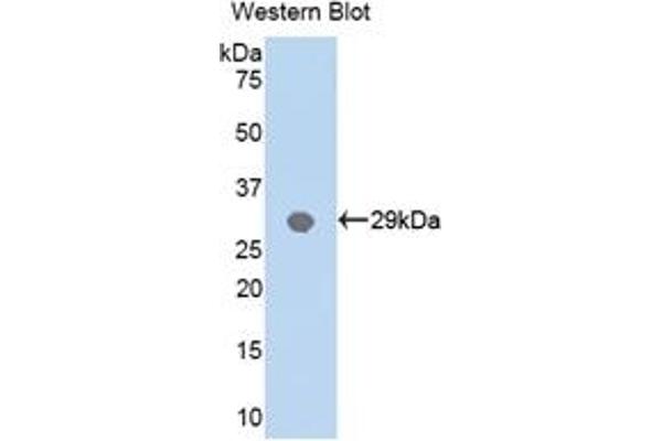 MYD88 Antikörper  (AA 32-265)