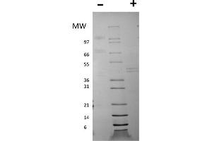 Image no. 2 for Interleukin 12 (IL12) protein (ABIN6700019)