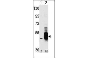 Image no. 2 for anti-Mitogen-Activated Protein Kinase Kinase Kinase 8 (MAP3K8) (C-Term) antibody (ABIN360298)