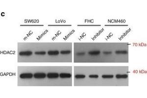 Image no. 16 for anti-Histone Deacetylase 2 (HDAC2) antibody (ABIN3022867)