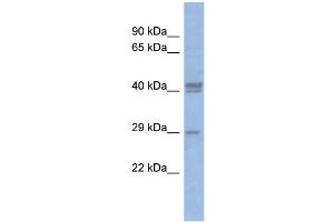 Image no. 1 for anti-CCAAT/enhancer Binding Protein (C/EBP), delta (CEBPD) (Middle Region) antibody (ABIN2780657)